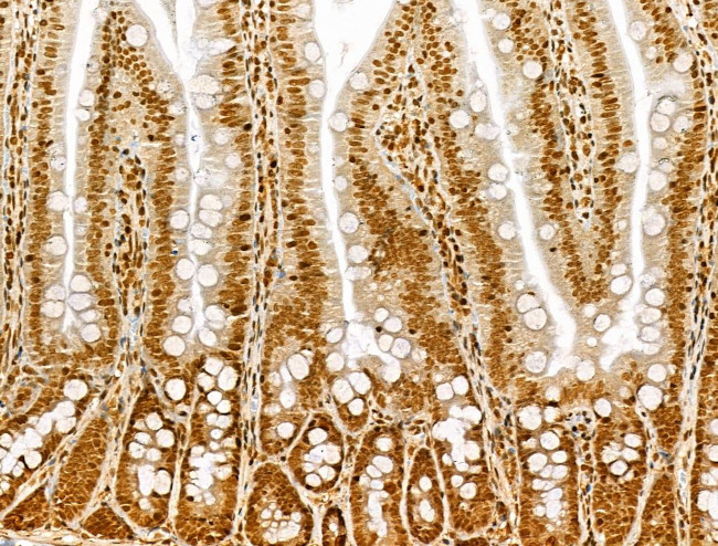 Phospho-Bcl-2 (Thr56) Antibody in Immunohistochemistry (Paraffin) (IHC (P))