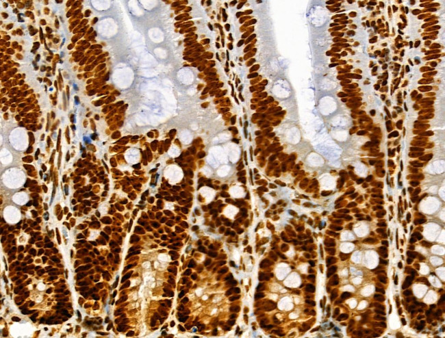 Phospho-SRF (Ser103) Antibody in Immunohistochemistry (Paraffin) (IHC (P))