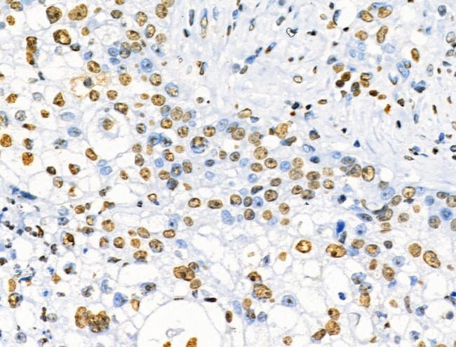 Phospho-SRF (Ser103) Antibody in Immunohistochemistry (Paraffin) (IHC (P))