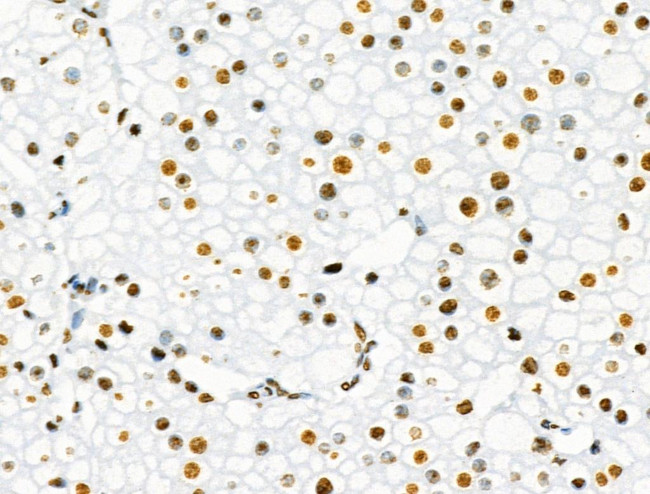 Phospho-SRF (Ser103) Antibody in Immunohistochemistry (Paraffin) (IHC (P))