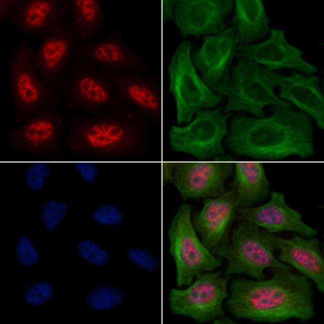 Phospho-SRC (Ser17) Antibody in Immunocytochemistry (ICC/IF)