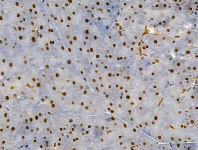 Phospho-SRC (Ser17) Antibody in Immunohistochemistry (Paraffin) (IHC (P))