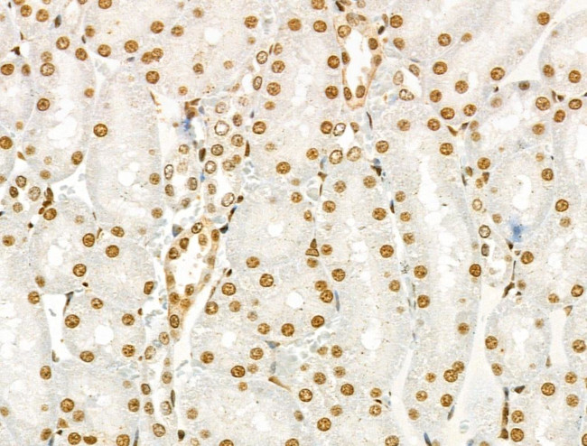 Phospho-SRC (Ser17) Antibody in Immunohistochemistry (Paraffin) (IHC (P))