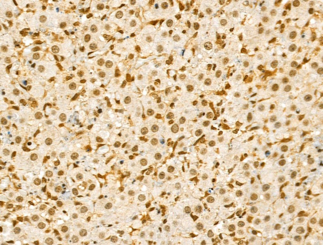 Phospho-SRC (Ser17) Antibody in Immunohistochemistry (Paraffin) (IHC (P))