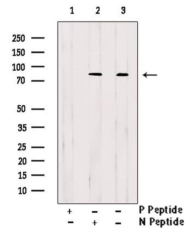 Phospho-HCLS1 (Tyr397) Antibody in Western Blot (WB)