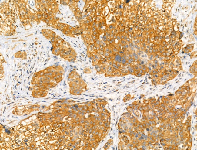 Phospho-NR4A1 (Ser351) Antibody in Immunohistochemistry (Paraffin) (IHC (P))