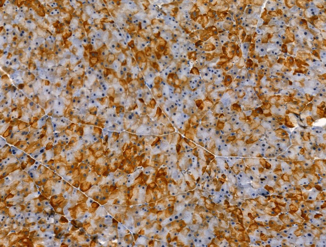 Phospho-NR4A1 (Ser351) Antibody in Immunohistochemistry (Paraffin) (IHC (P))