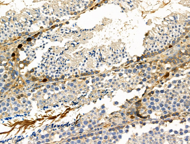 Phospho-CAD (Ser1859) Antibody in Immunohistochemistry (Paraffin) (IHC (P))