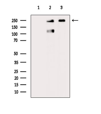 Phospho-CAD (Ser1859) Antibody in Western Blot (WB)