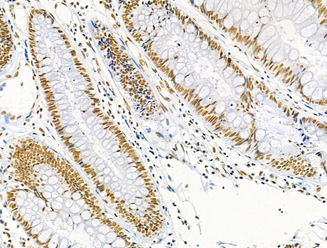 Phospho-MKP-1 (Ser359) Antibody in Immunohistochemistry (Paraffin) (IHC (P))