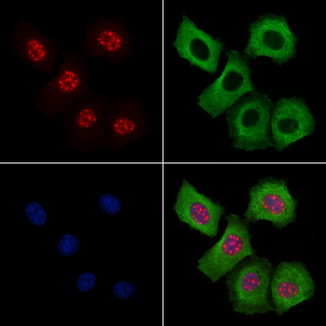 Phospho-AKT1 (Ser124) Antibody in Immunocytochemistry (ICC/IF)