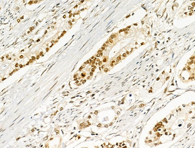 Phospho-AKT1 (Ser124) Antibody in Immunohistochemistry (Paraffin) (IHC (P))