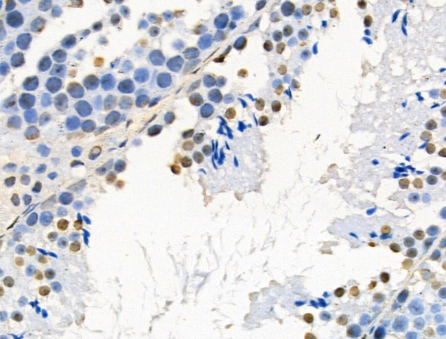 Phospho-AKT1 (Ser124) Antibody in Immunohistochemistry (Paraffin) (IHC (P))