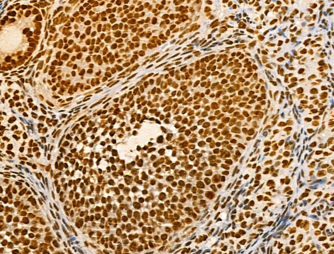 Phospho-AKT1 (Ser124) Antibody in Immunohistochemistry (Paraffin) (IHC (P))