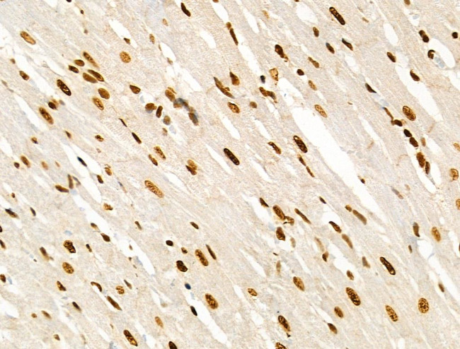 Phospho-AKT1 (Ser124) Antibody in Immunohistochemistry (Paraffin) (IHC (P))