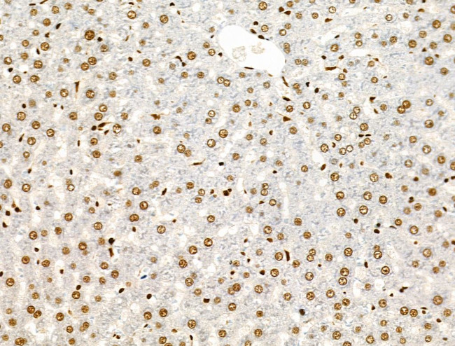 Phospho-AKT1 (Ser124) Antibody in Immunohistochemistry (Paraffin) (IHC (P))