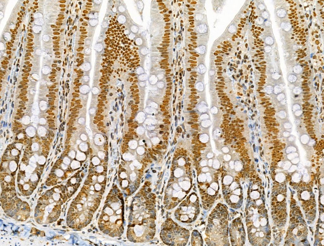 Phospho-AKT1 (Ser124) Antibody in Immunohistochemistry (Paraffin) (IHC (P))