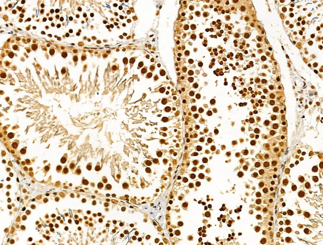 Phospho-AKT1 (Ser124) Antibody in Immunohistochemistry (Paraffin) (IHC (P))