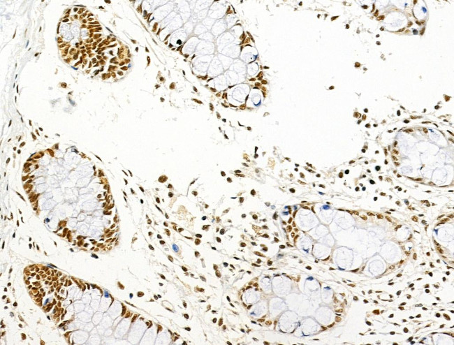 Phospho-AKT1 (Ser124) Antibody in Immunohistochemistry (Paraffin) (IHC (P))