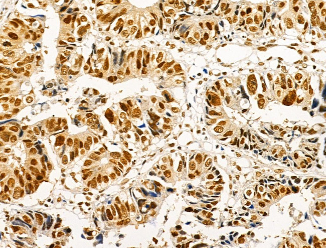 Phospho-AKT1 (Ser124) Antibody in Immunohistochemistry (Paraffin) (IHC (P))