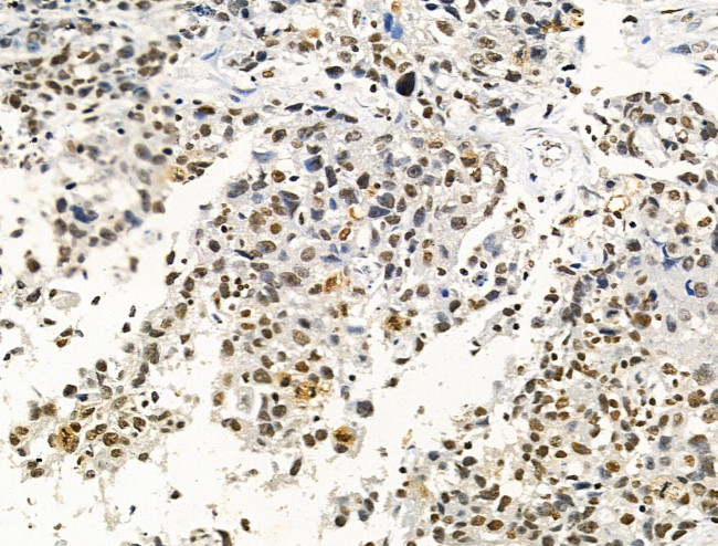 Phospho-AKT1 (Ser124) Antibody in Immunohistochemistry (Paraffin) (IHC (P))