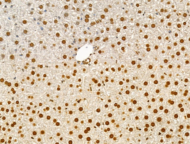 Phospho-AKT1 (Ser124) Antibody in Immunohistochemistry (Paraffin) (IHC (P))