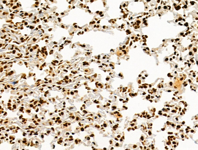 Phospho-AKT1 (Ser124) Antibody in Immunohistochemistry (Paraffin) (IHC (P))