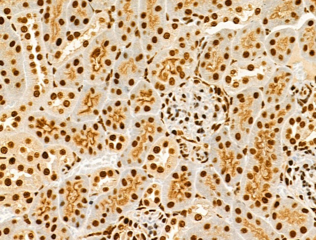 Phospho-AKT1 (Ser124) Antibody in Immunohistochemistry (Paraffin) (IHC (P))