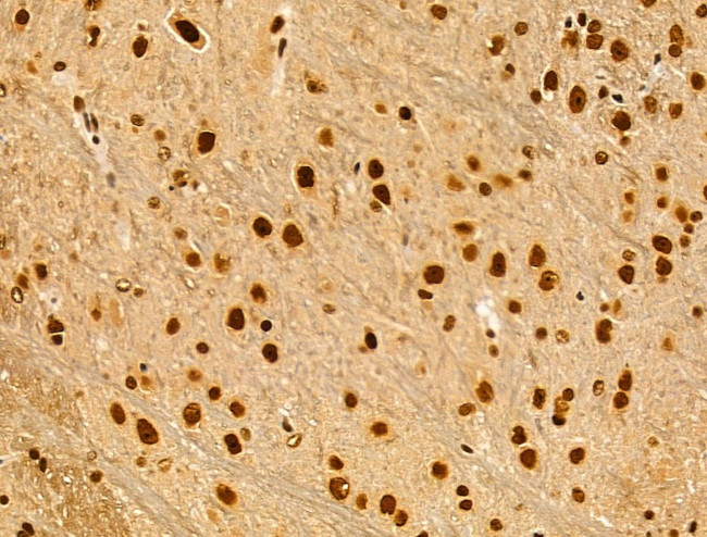 Phospho-AKT1 (Ser124) Antibody in Immunohistochemistry (Paraffin) (IHC (P))