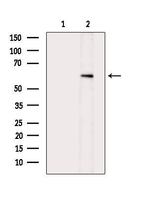 Phospho-AKT1 (Ser124) Antibody in Western Blot (WB)