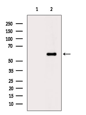 Phospho-OPRK1 (Tyr369) Antibody in Western Blot (WB)