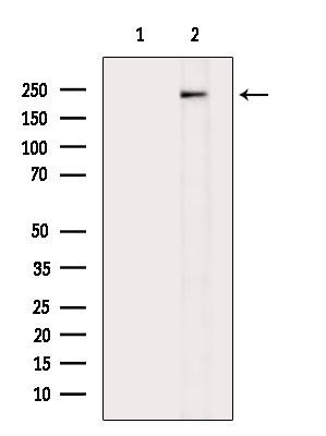 Phospho-VEGF Receptor 2 (Tyr1175) Antibody in Western Blot (WB)