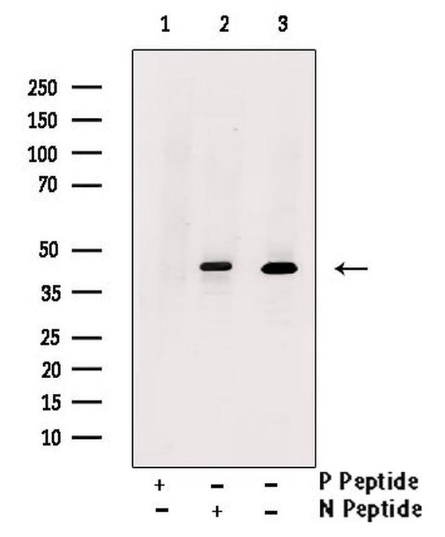 Phospho-Nkx2.1 (Ser327) Antibody in Western Blot (WB)