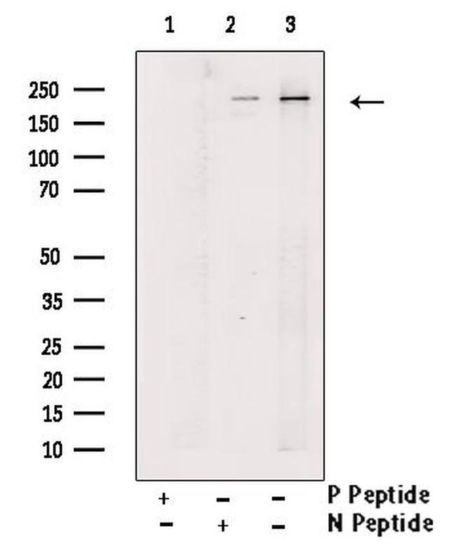 Phospho-TSC2 (Ser1387) Antibody in Western Blot (WB)