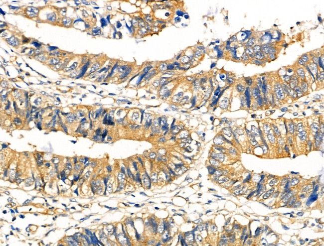 Phospho-TSC2 (Ser1387) Antibody in Immunohistochemistry (Paraffin) (IHC (P))