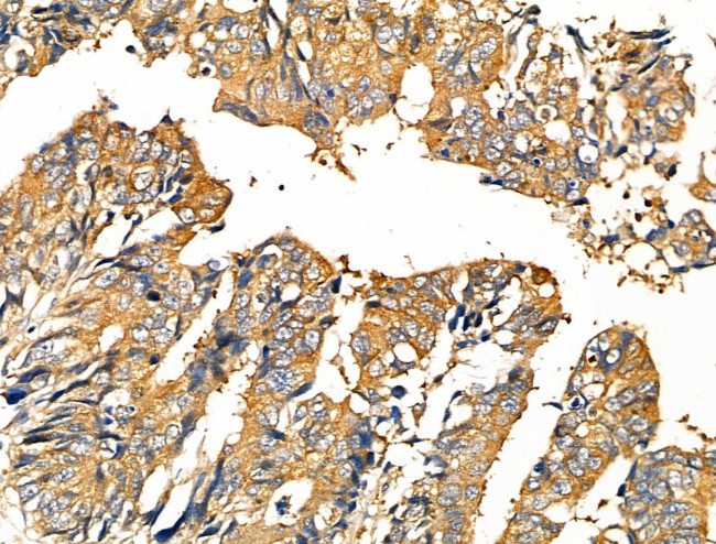 Phospho-TSC2 (Ser1387) Antibody in Immunohistochemistry (Paraffin) (IHC (P))