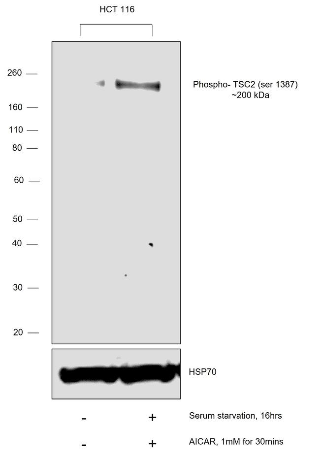 Phospho-TSC2 (Ser1387) Antibody in Western Blot (WB)