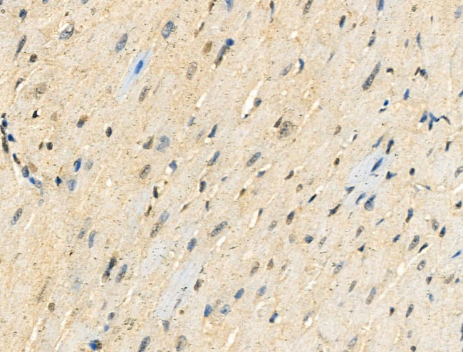 Phospho-CDK9 (Thr186) Antibody in Immunohistochemistry (Paraffin) (IHC (P))