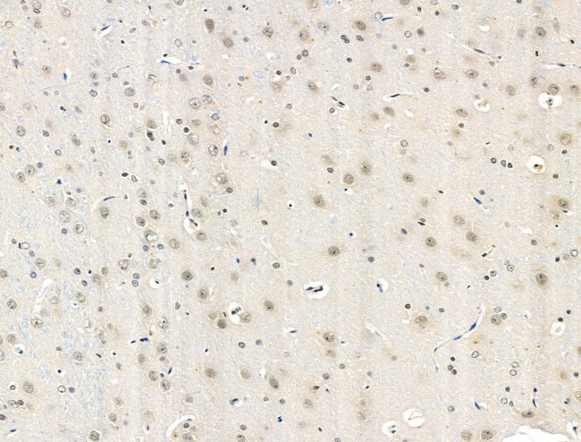 Phospho-CDK9 (Thr186) Antibody in Immunohistochemistry (Paraffin) (IHC (P))