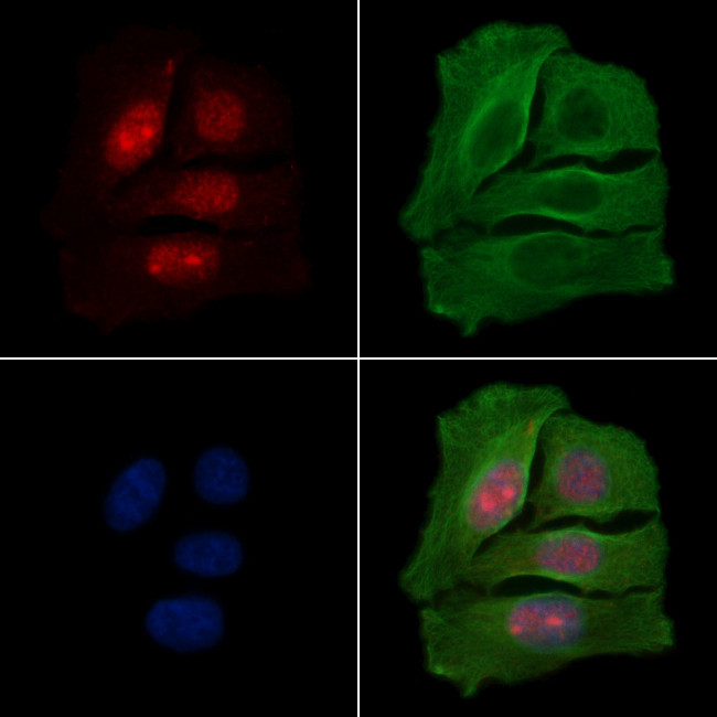 Phospho-IRAK1 (Thr100) Antibody in Immunocytochemistry (ICC/IF)