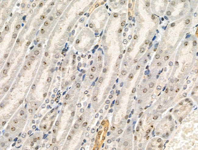 Phospho-IRAK1 (Thr100) Antibody in Immunohistochemistry (Paraffin) (IHC (P))