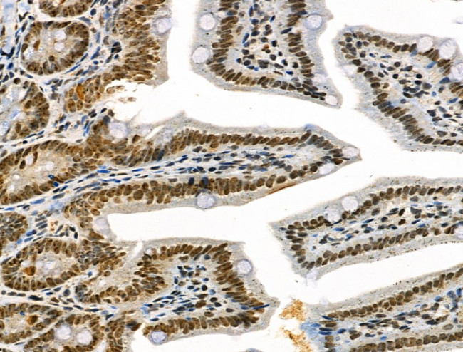 Phospho-IRAK1 (Thr100) Antibody in Immunohistochemistry (Paraffin) (IHC (P))