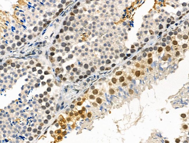 Phospho-IRAK1 (Thr100) Antibody in Immunohistochemistry (Paraffin) (IHC (P))