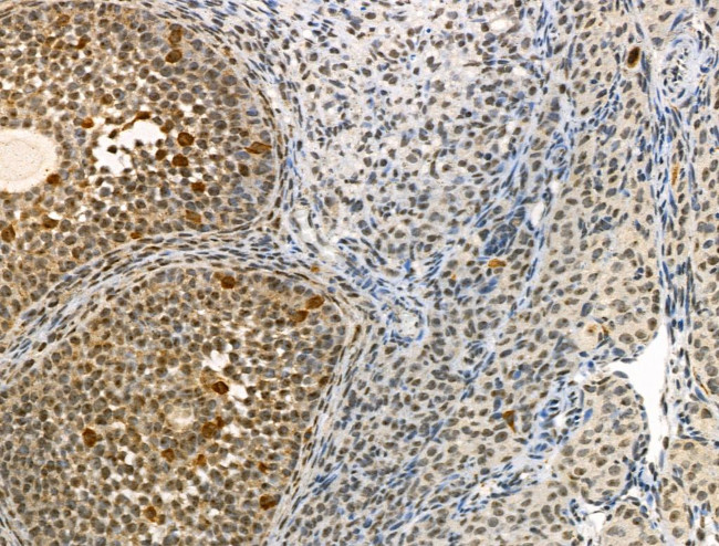 Phospho-IRAK1 (Thr100) Antibody in Immunohistochemistry (Paraffin) (IHC (P))