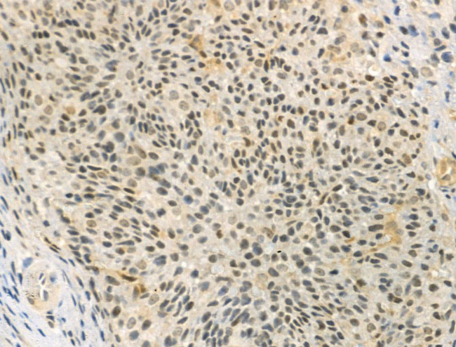 Phospho-IRAK1 (Thr100) Antibody in Immunohistochemistry (Paraffin) (IHC (P))