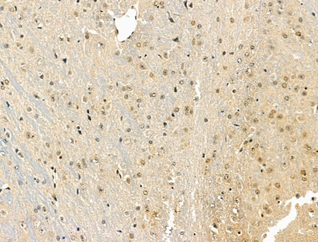 Phospho-IRAK1 (Thr209) Antibody in Immunohistochemistry (Paraffin) (IHC (P))