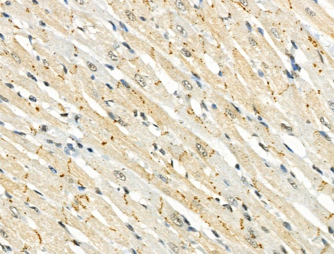 Phospho-IRAK1 (Thr209) Antibody in Immunohistochemistry (Paraffin) (IHC (P))