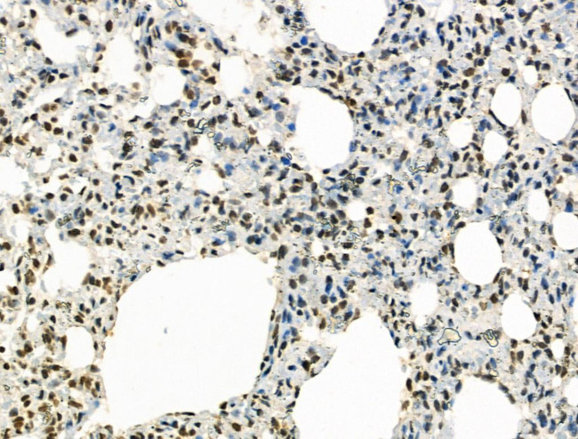 Phospho-IRAK1 (Thr209) Antibody in Immunohistochemistry (Paraffin) (IHC (P))