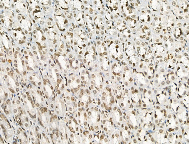 Phospho-IRAK1 (Thr209) Antibody in Immunohistochemistry (Paraffin) (IHC (P))