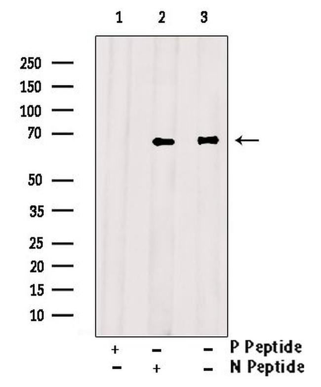 Phospho-ETK (Tyr40) Antibody in Western Blot (WB)